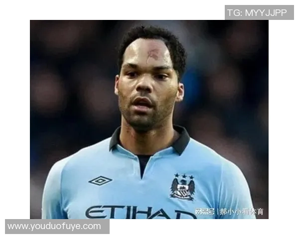 法国足球史上最丑球星的真实面貌和背后的奋斗故事 法国足球史上最丑球星的真实面貌和背后的奋斗故事